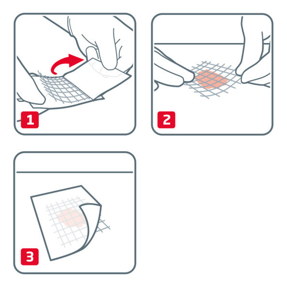Leukoplast Cuticell Classic sterilní krytí 5×5 cm 5 ks