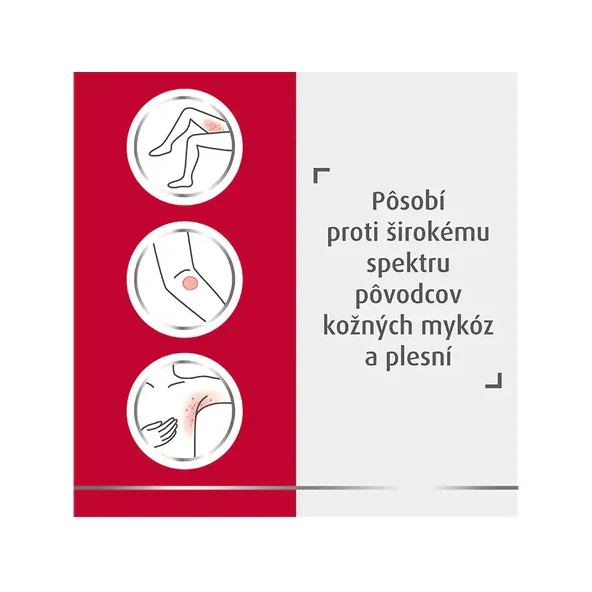 Canesten dermální krém proti mykóze 50 g