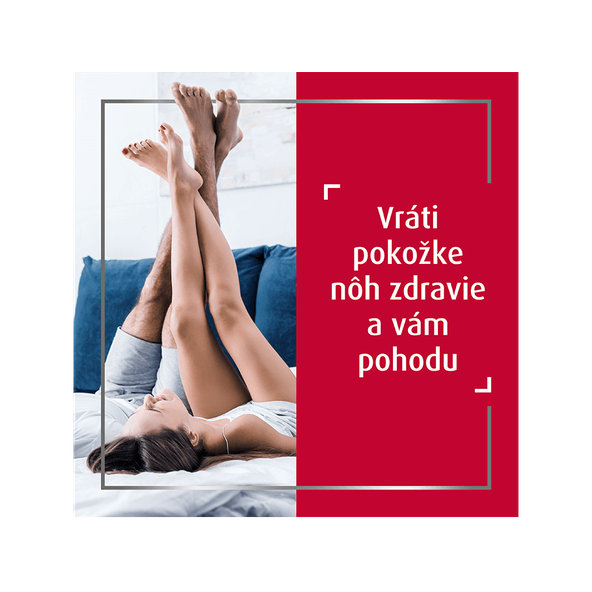 Canesten dermální krém proti mykóze 50 g