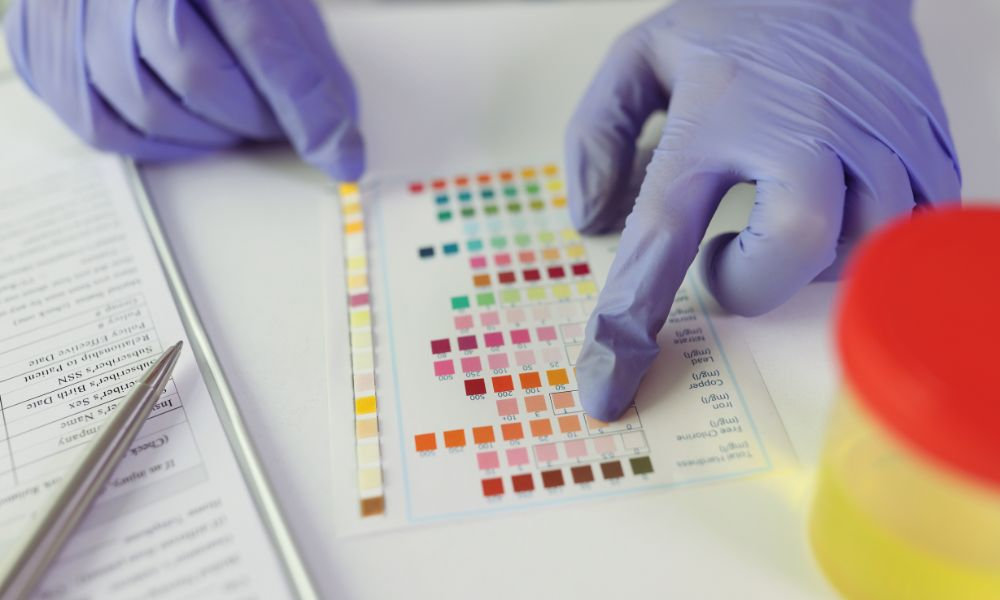  Hematúria a diagnostika – Lekár porovnáva výsledky testov na krv v moči s farebnou diagnostickou tabuľkou.