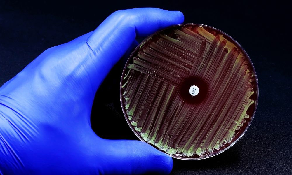  Zlatý stafylokok v laboratóriu – Kultivácia baktérií na Petriho miske s antibiotickým testom.