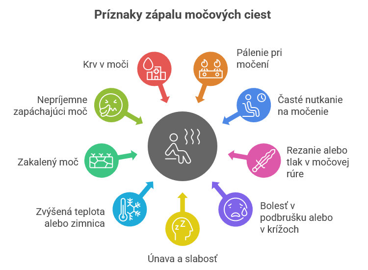  Príznaky zápalu močových ciest